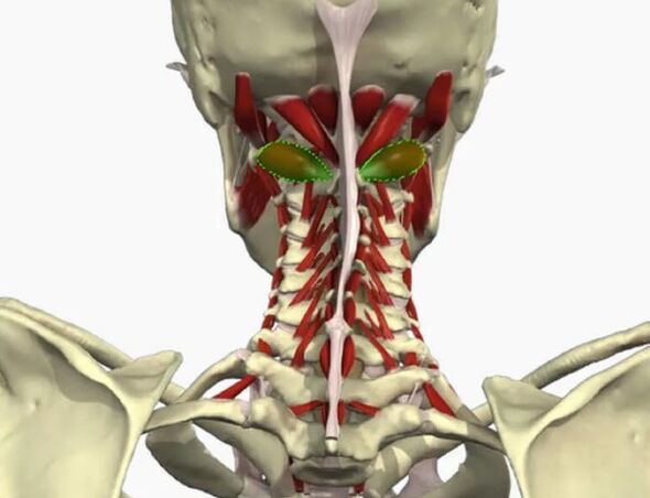 Sindroma e arteries vertebrale